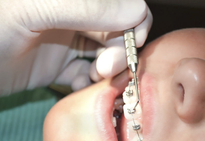 ortodonzia-dr-a-rossi