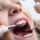 Odontoiatria-Conservativa-ed-Endodonzia