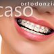 sezione-ortodonzia-caso1