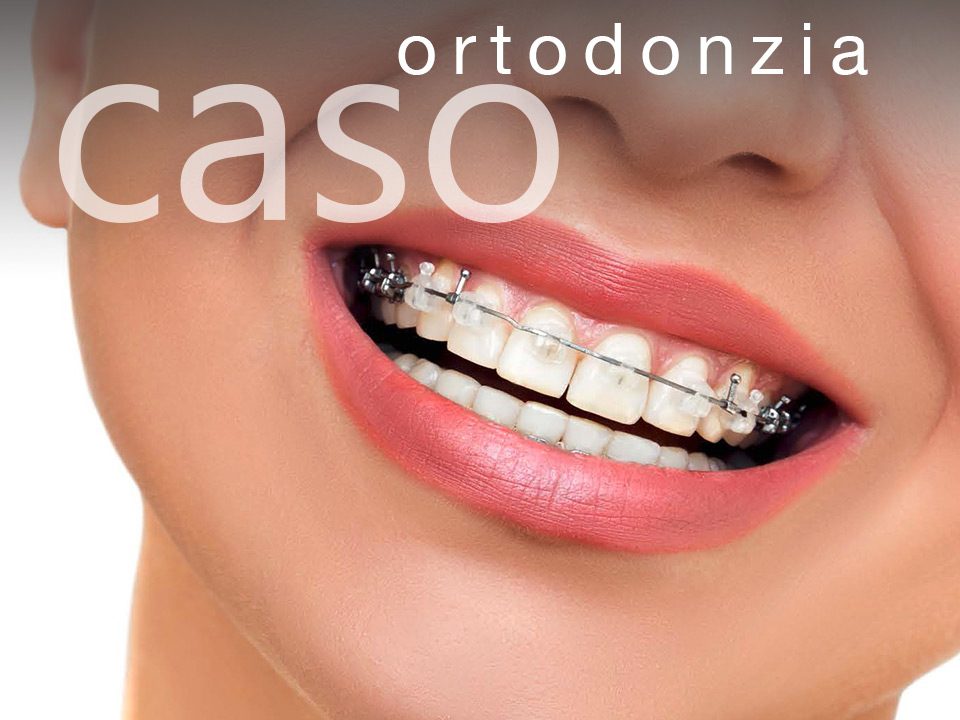 sezione-ortodonzia-caso1