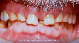 2_bocca-centro-prima_-dr.-alfredo-rossi