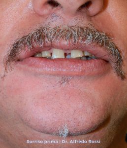 4_sorriso-prima_-dr.-alfredo-rossi
